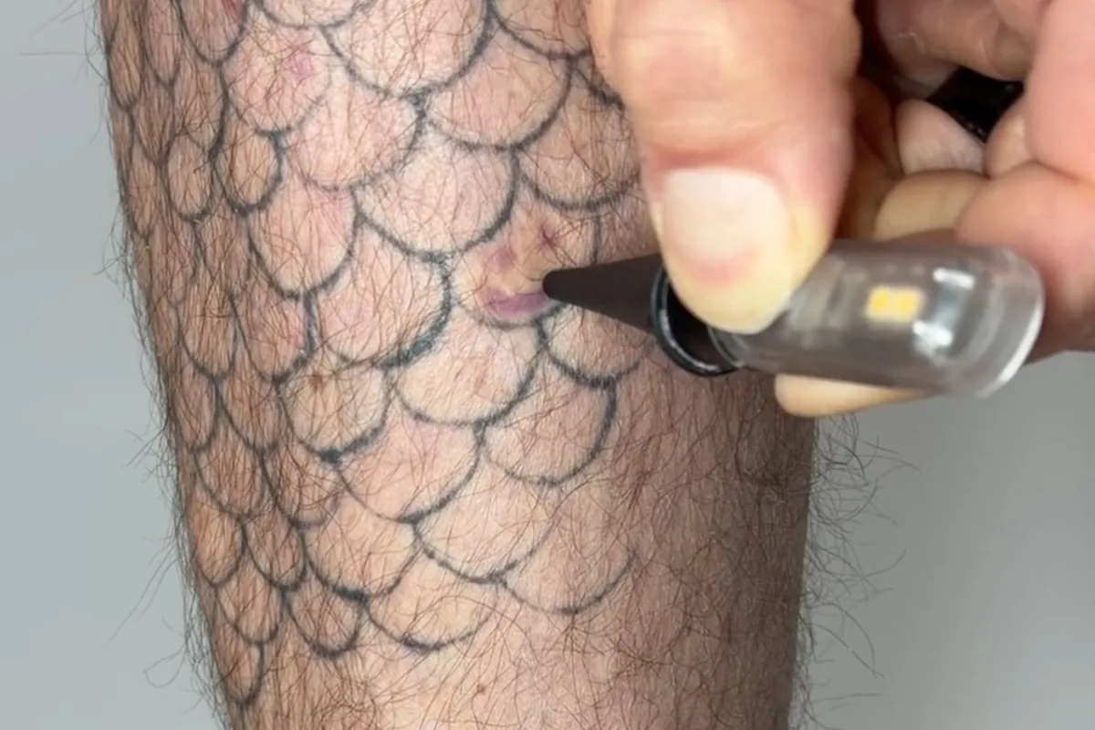 Light-sensitive tattoo ink may allow temporary visibility control