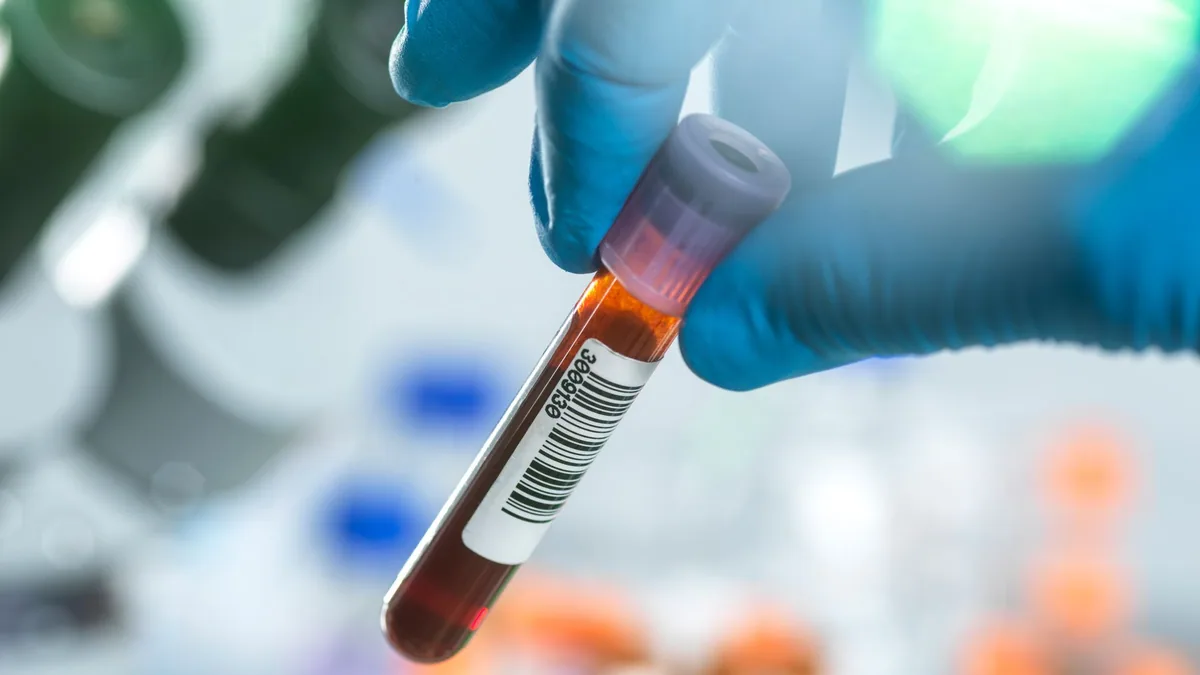 Blood protein ratio linked to aging risk